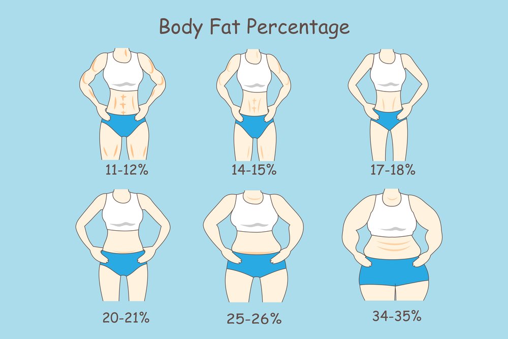 BMI index.