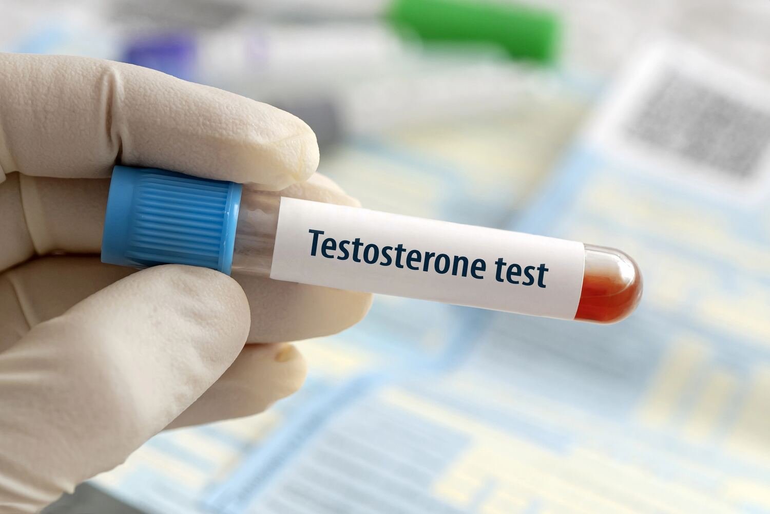 Ako naturálne zvýšiť hladinu testosterónu?